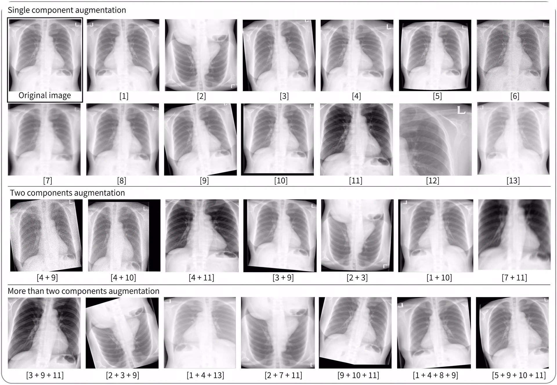 Augmented X-ray images