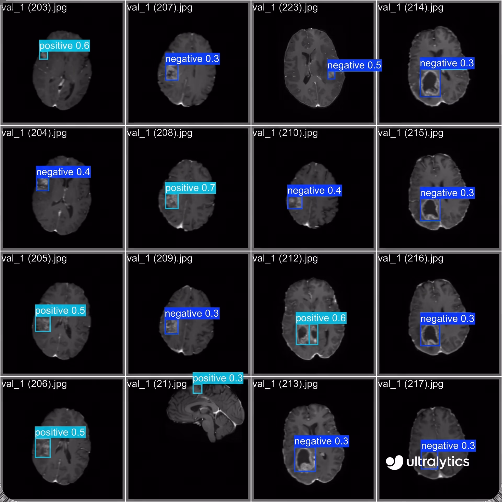 Ultralytics YOLO11 identifying abnormalities in brain MRI scans