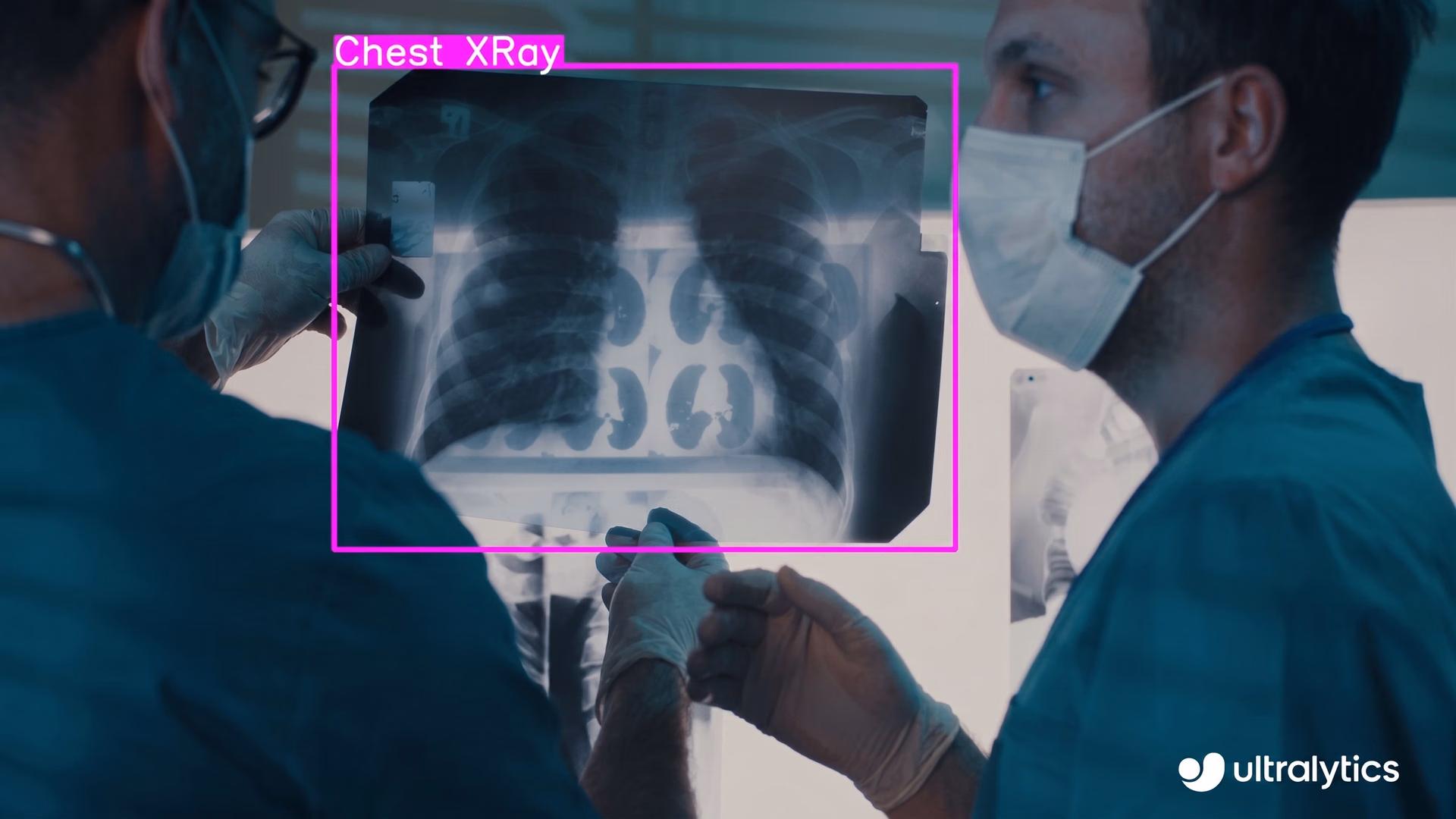 X-ray detection using Ultralytics YOLOv8