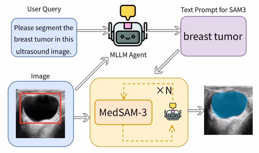 医療画像におけるテキストプロンプトによる腫瘍セグメンテーションのためのMedSAM-3パイプライン