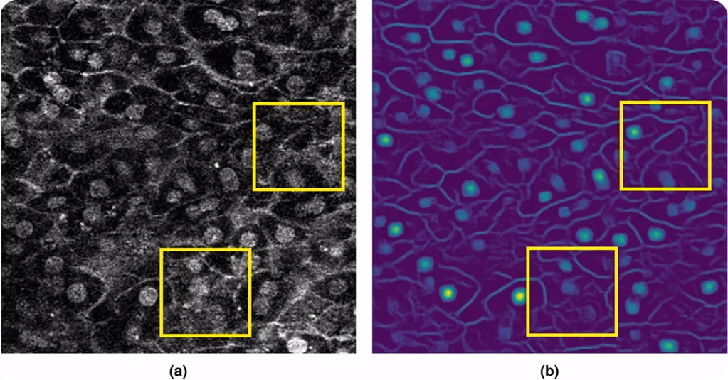 A poor-quality cell input image and the features preprocessing extracts