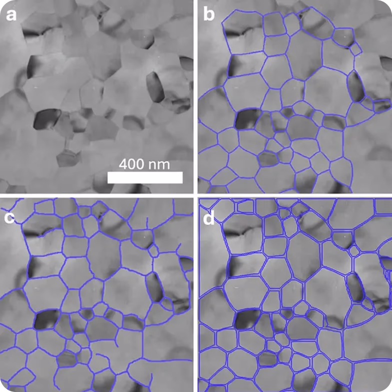YOLOv8 producing sharper segmentation outlines than U-Net in microscopy images