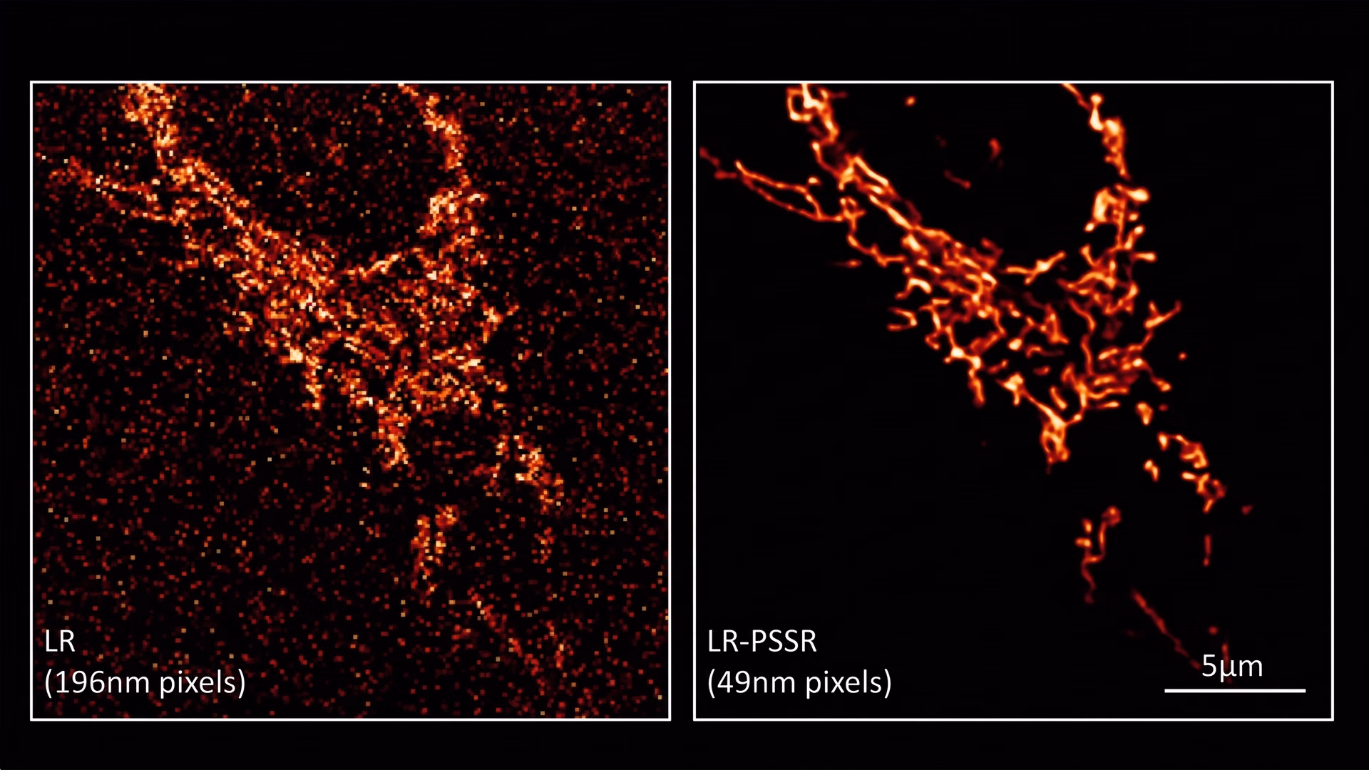 Un réseau mitochondrial dans une cellule cancéreuse, basse résolution par rapport à l'amélioration par IA