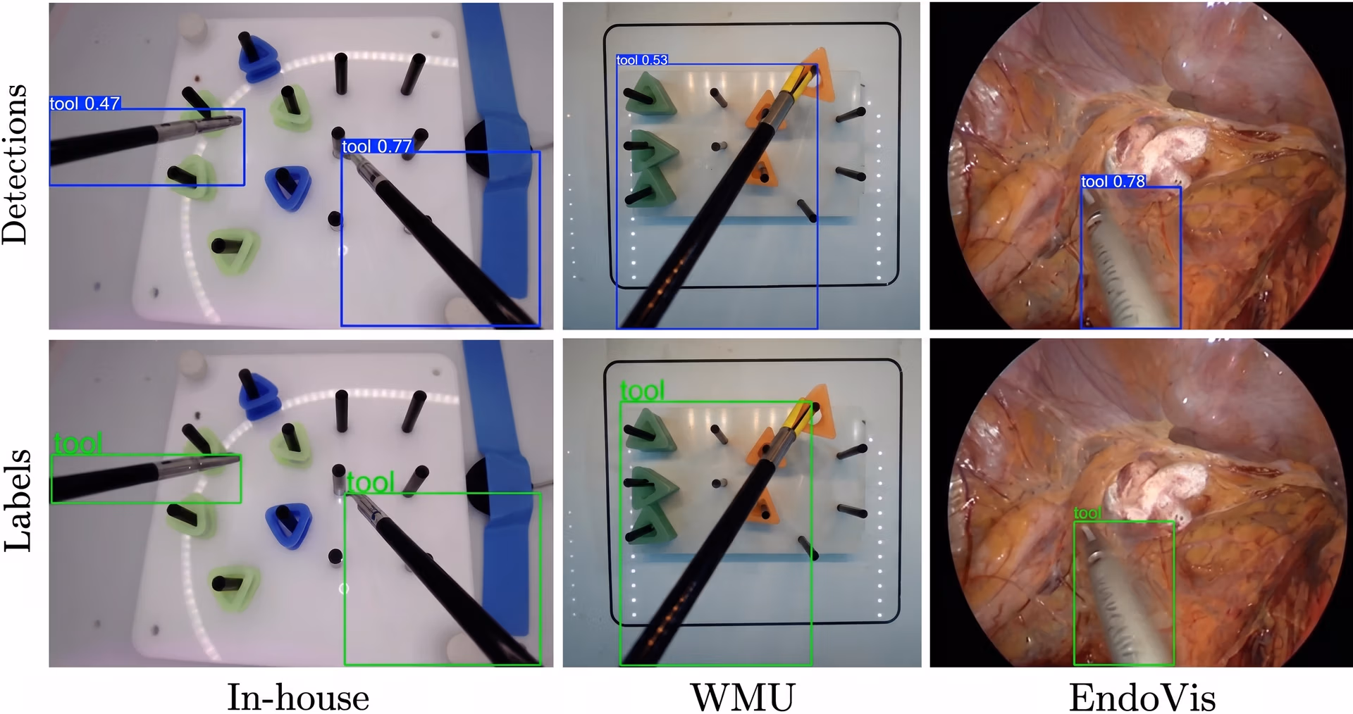 Real-time laparoscopic instrument detection using YOLO