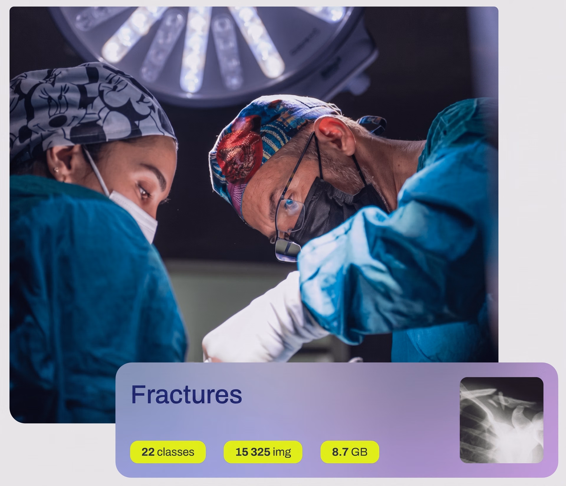 Ultralytics YOLO models analyzing fractures in X-ray datasets