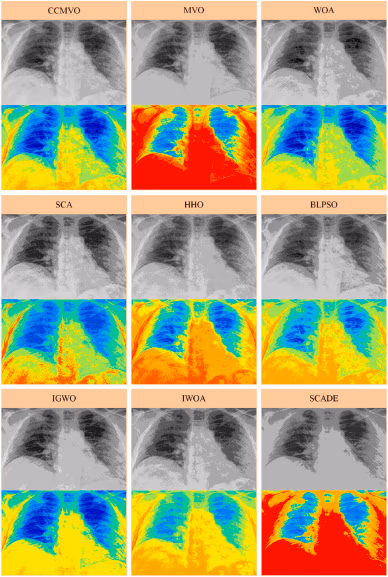 Utilizzo di metodi di thresholding multilivello su radiografie toraciche