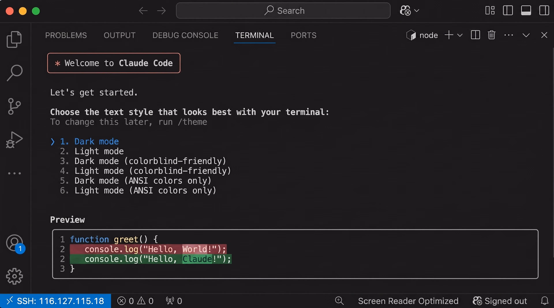 VS Code içindeki Claude Code arayüzü