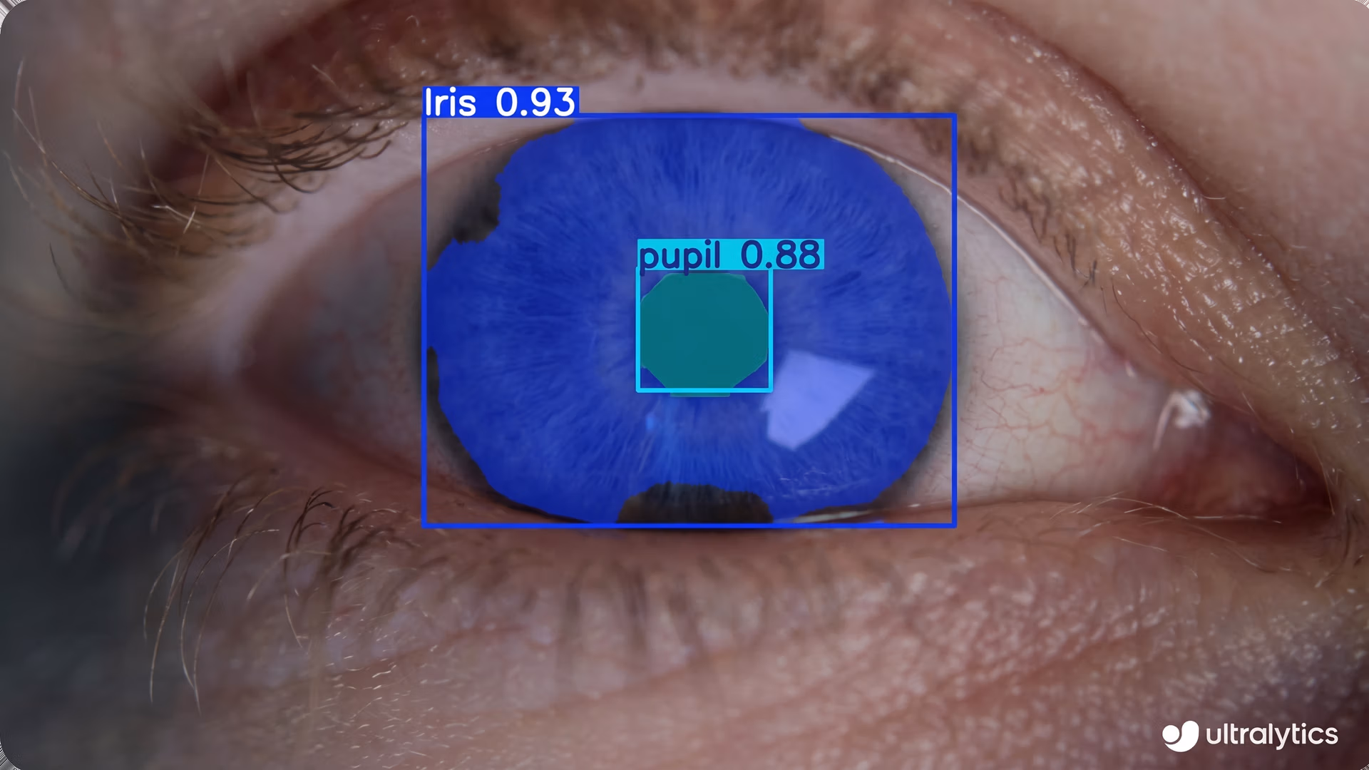 Ultralytics YOLO11 detecting a person's eye and pupil