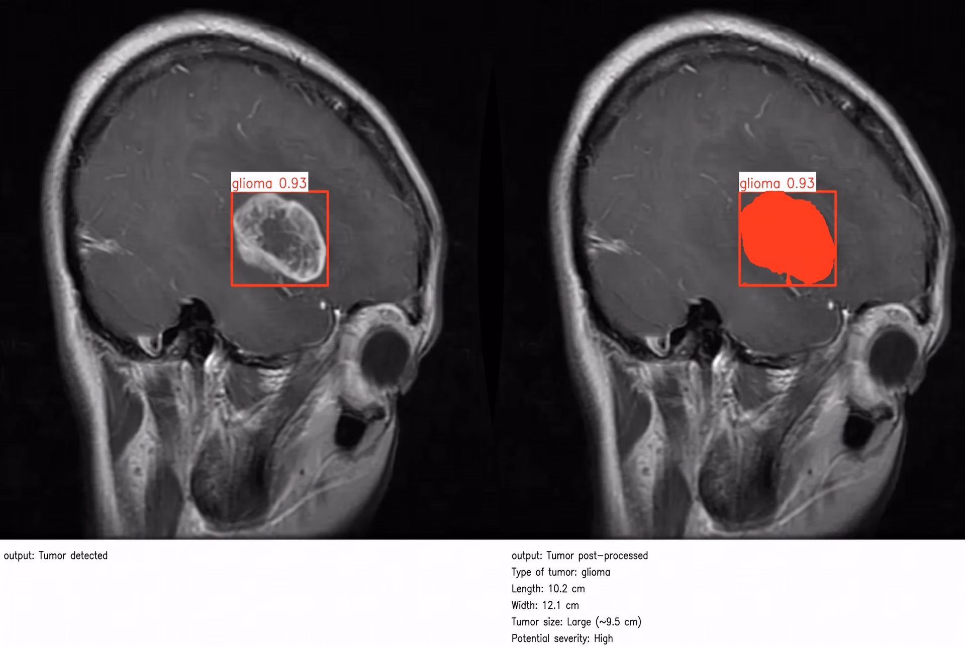 Computer vision used for medical image analysis