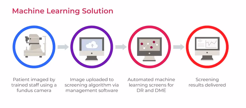 Cách machine learning được sử dụng để tầm soát DR và DME