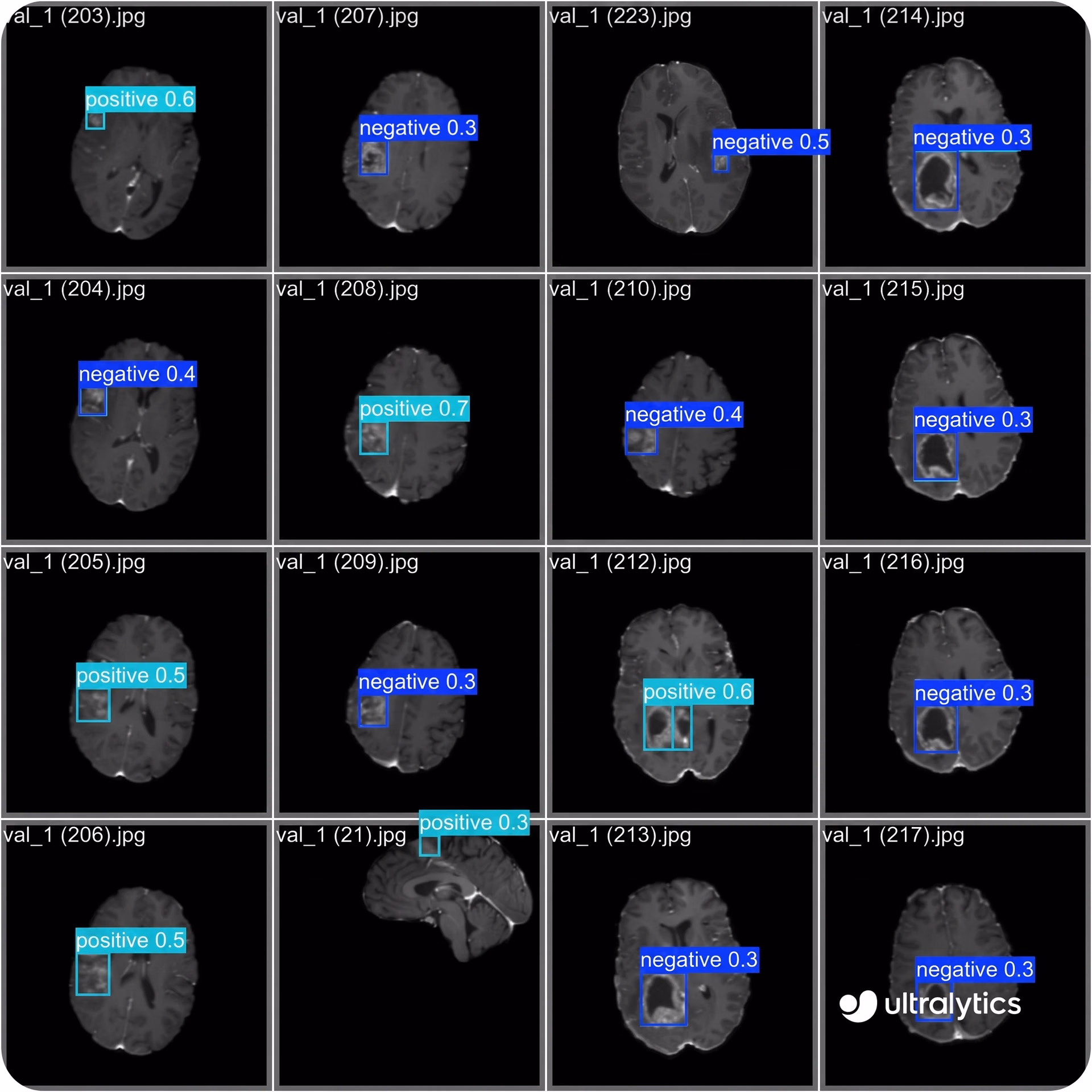 YOLO11 analyzing medical scans