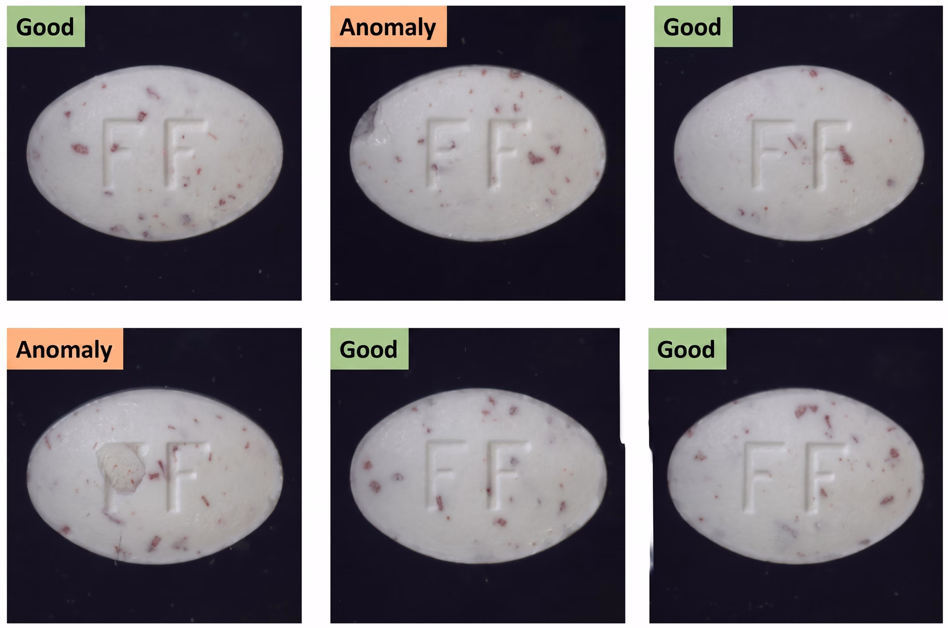 Anomaly detection in the pharmaceutical industry