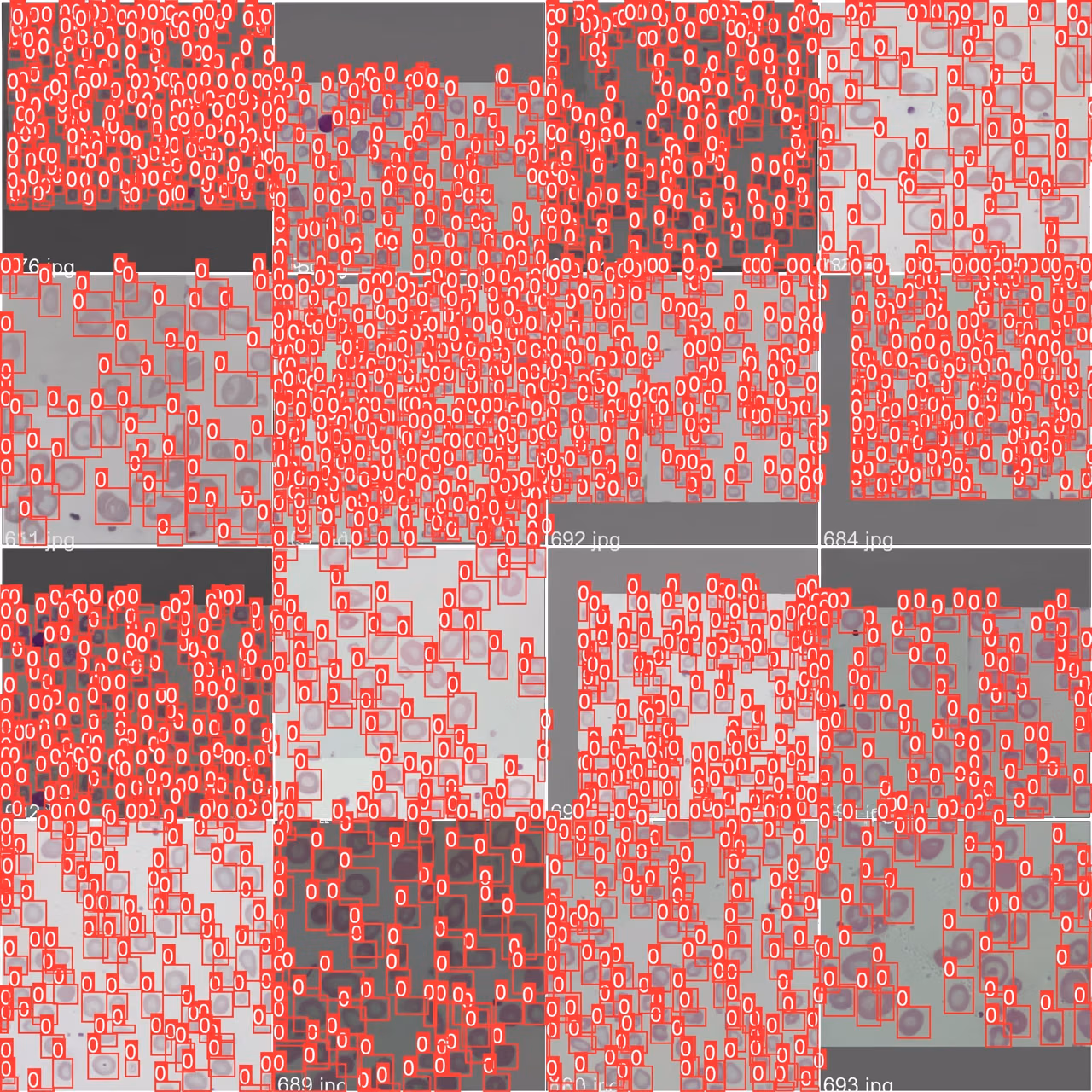Colony Counting with Ultralytics YOLOv5