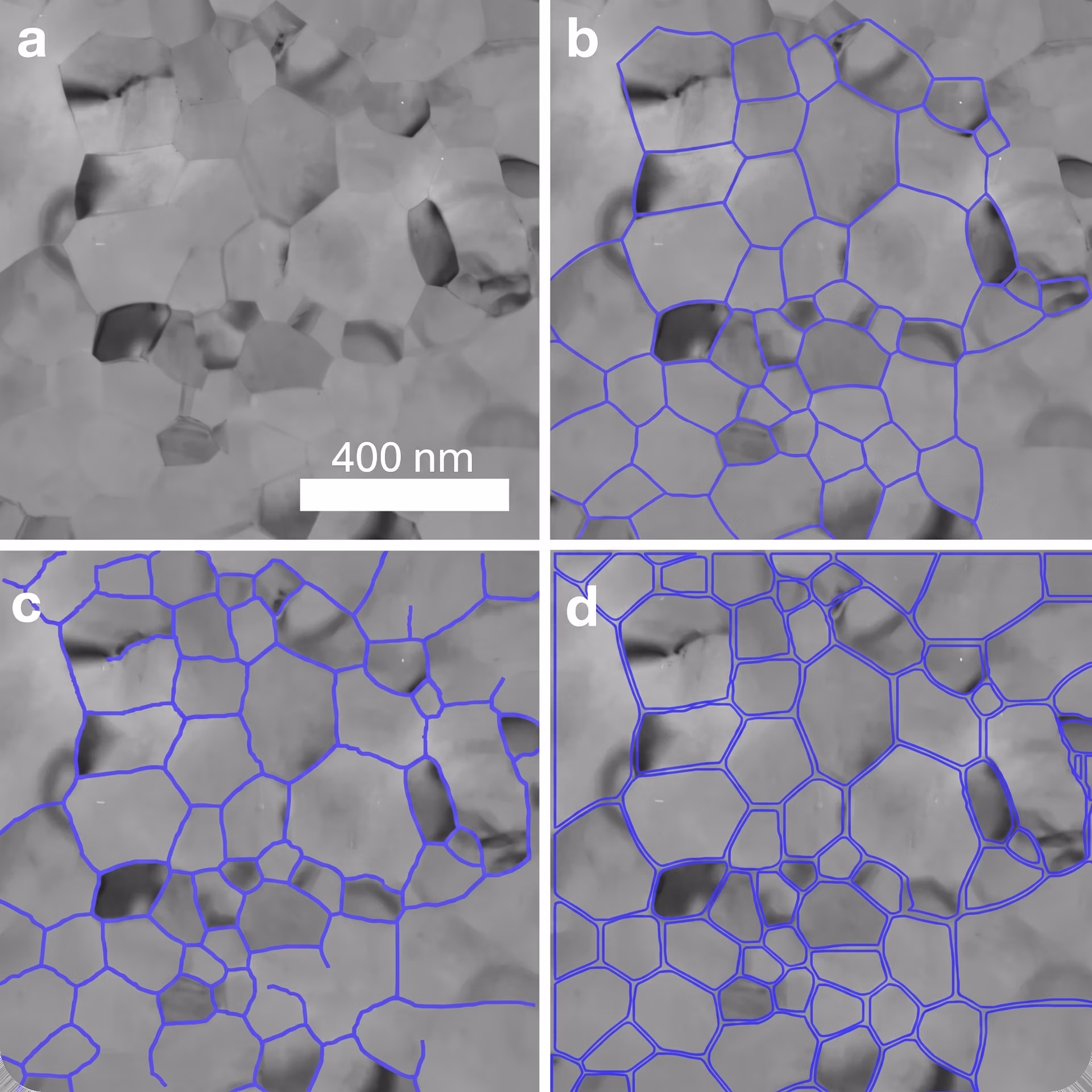 Ultralytics YOLOv8 producing sharper segmentation outlines than U-Net in microscopy images