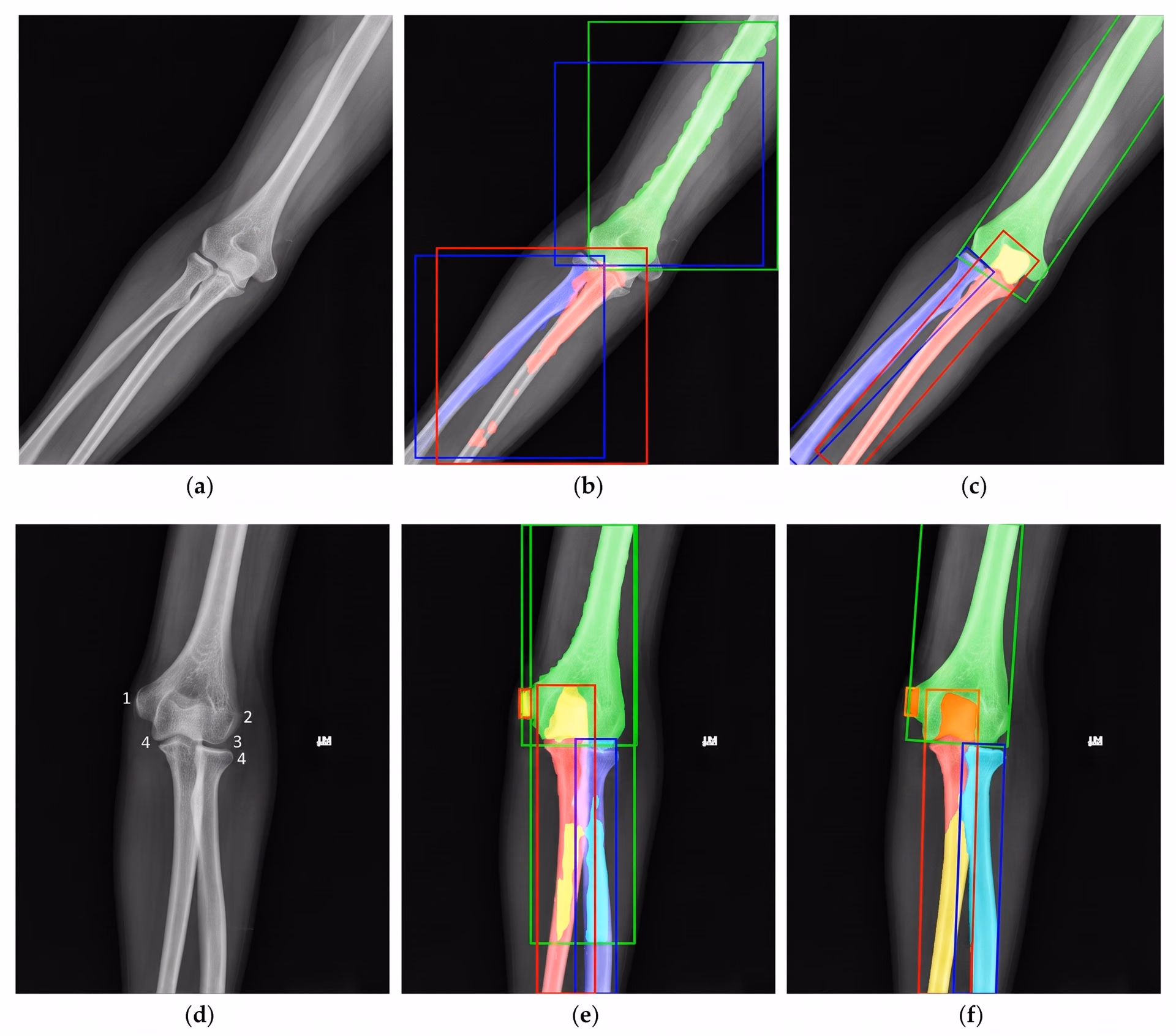 X-rays with object detection and oriented bounding box detection
