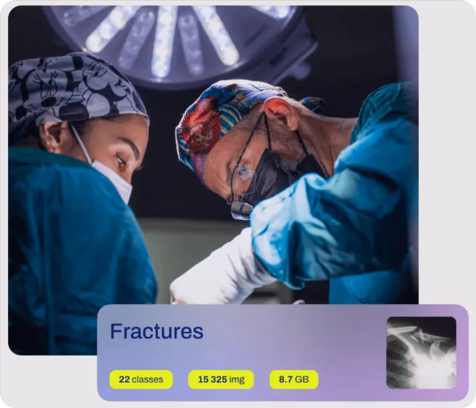 Les modèles Ultralytics YOLO analysant des fractures dans des jeux de données de radiographie