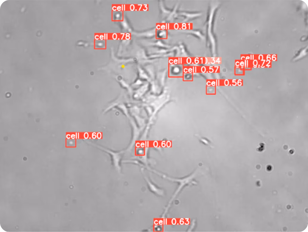 Segmentation results of YOLOv8 being used for cell detection