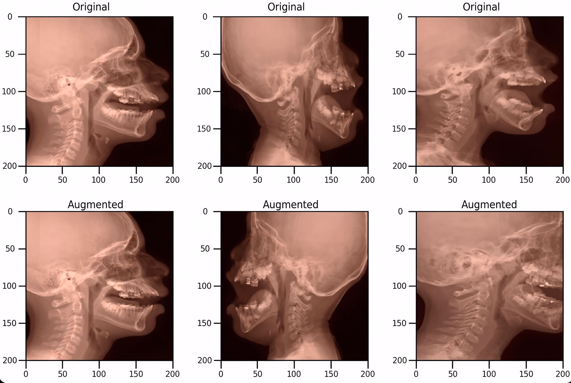 Original and augmented pediatric medical images