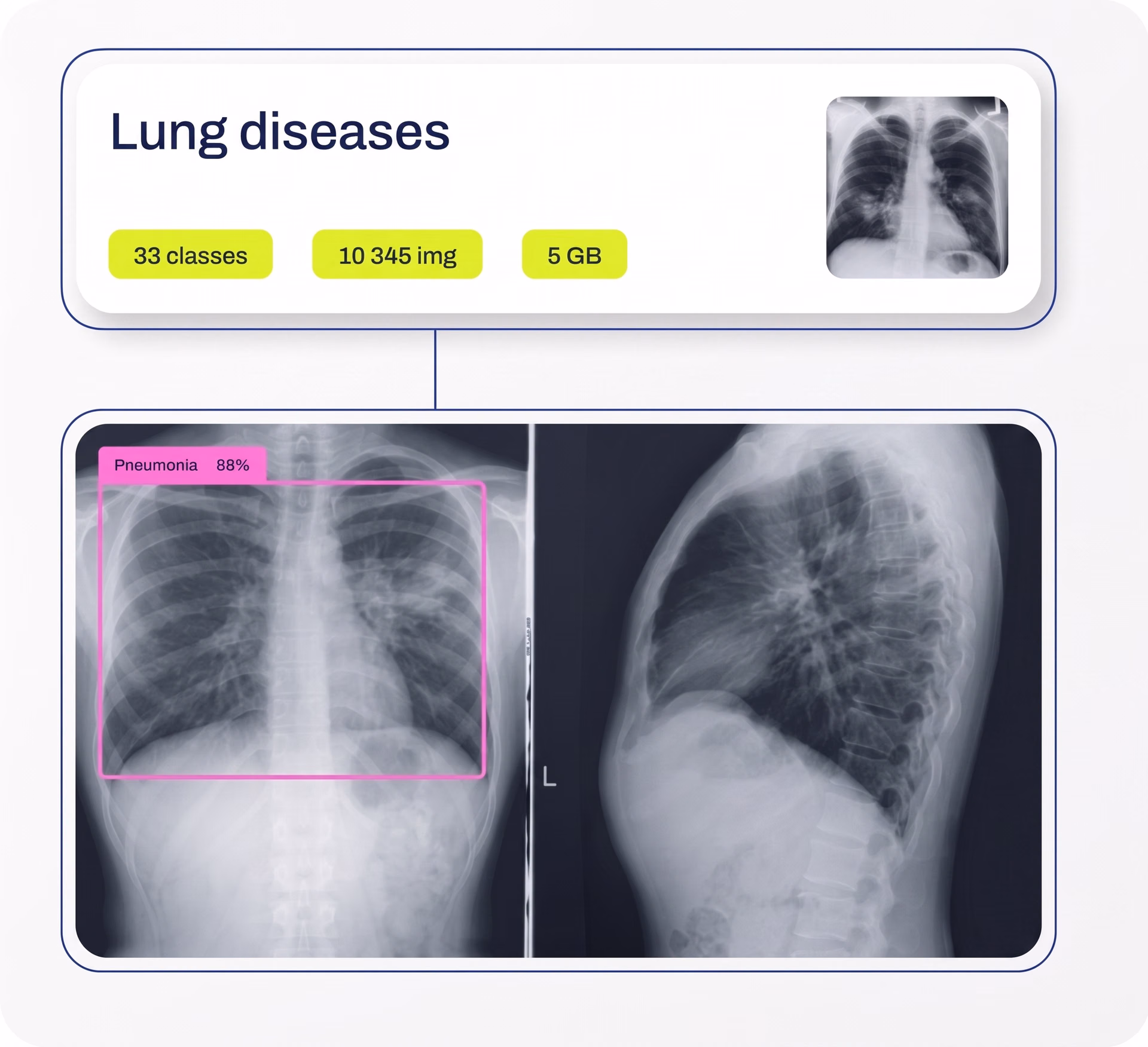 Analyzing medical images using Ultralytics YOLO11