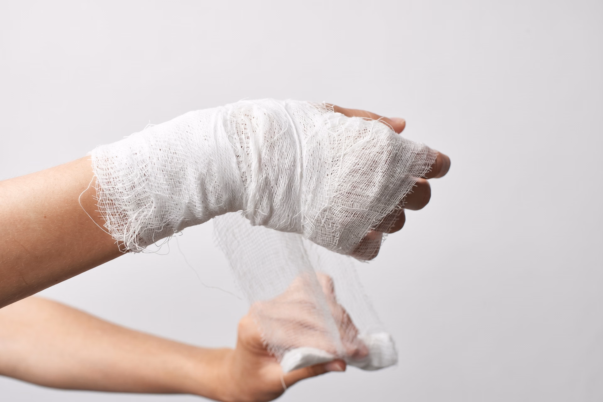 Detección de fracturas en rodete de muñeca con visión artificial