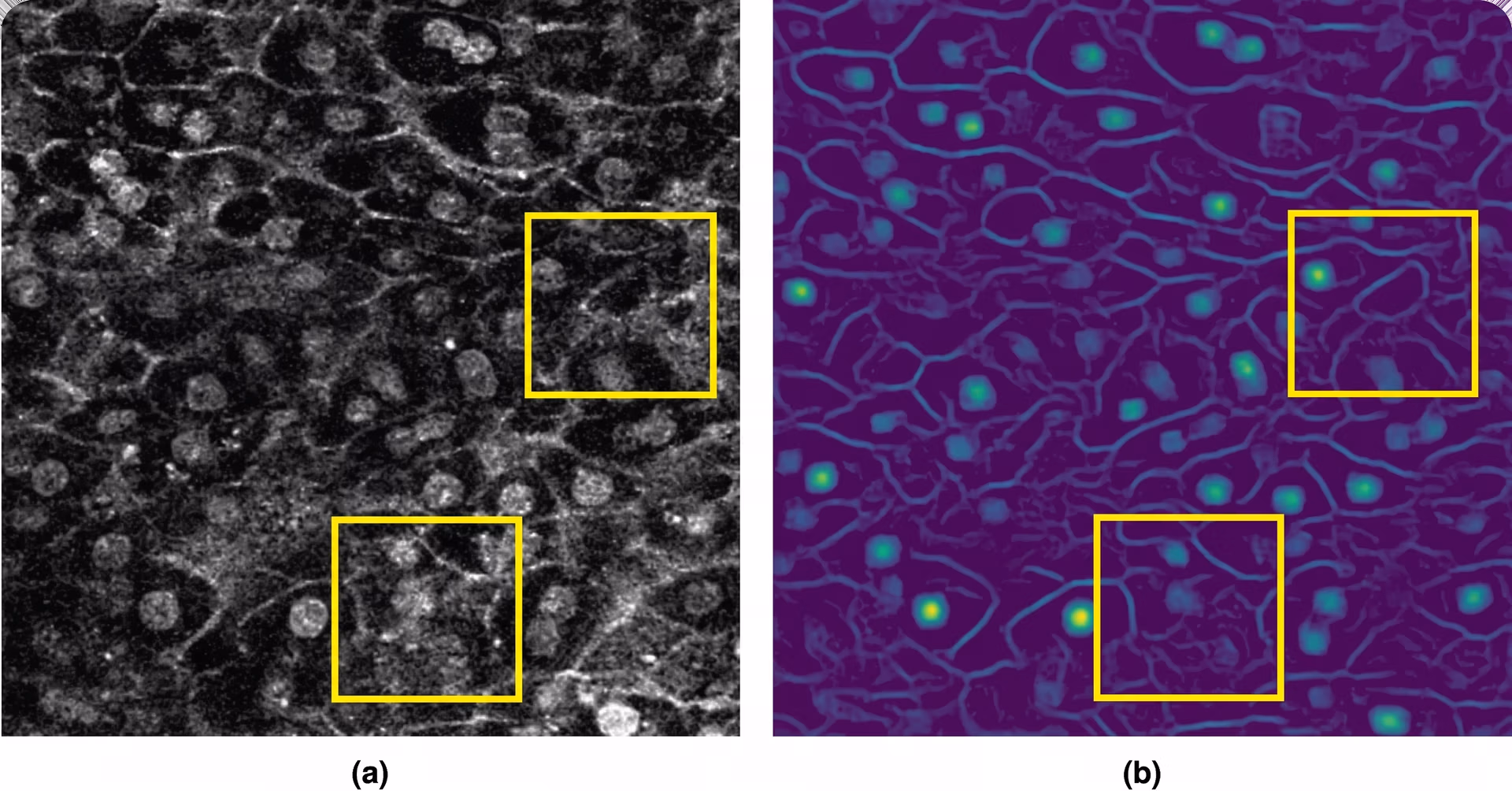 A poor-quality cell input image and the features preprocessing extracts