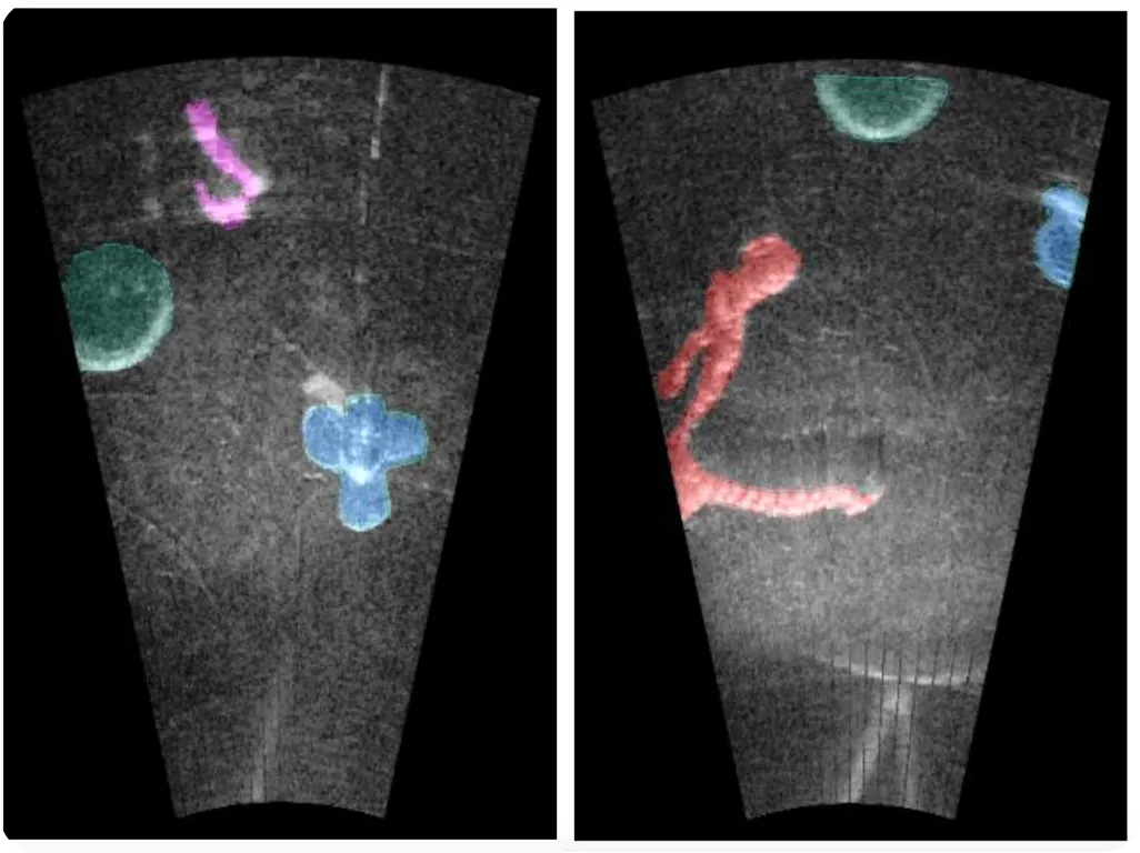 Sonar görüntülerinin segmentasyonu için ince ayarlı SAM kullanımı
