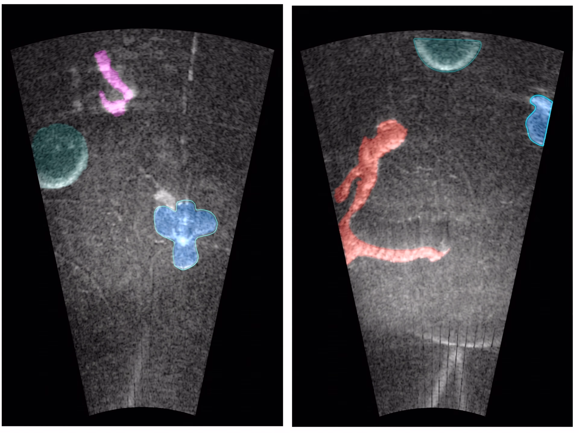 Using fine-tuned SAM for segmentation of sonar images
