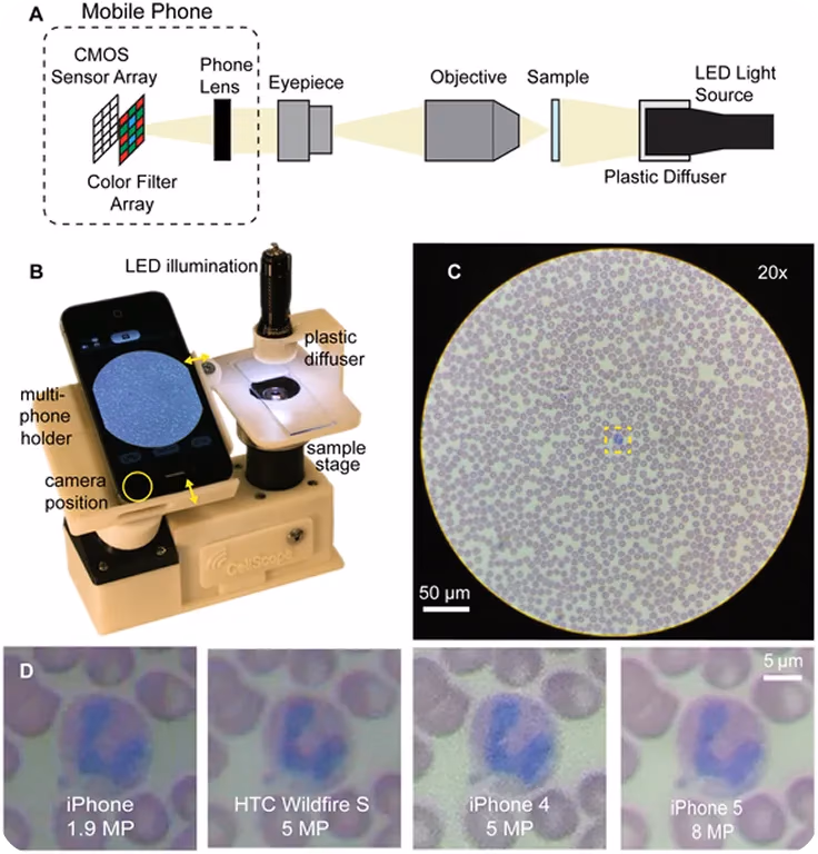 Utilisation d'un microscope basé sur smartphone pour l'imagerie cellulaire