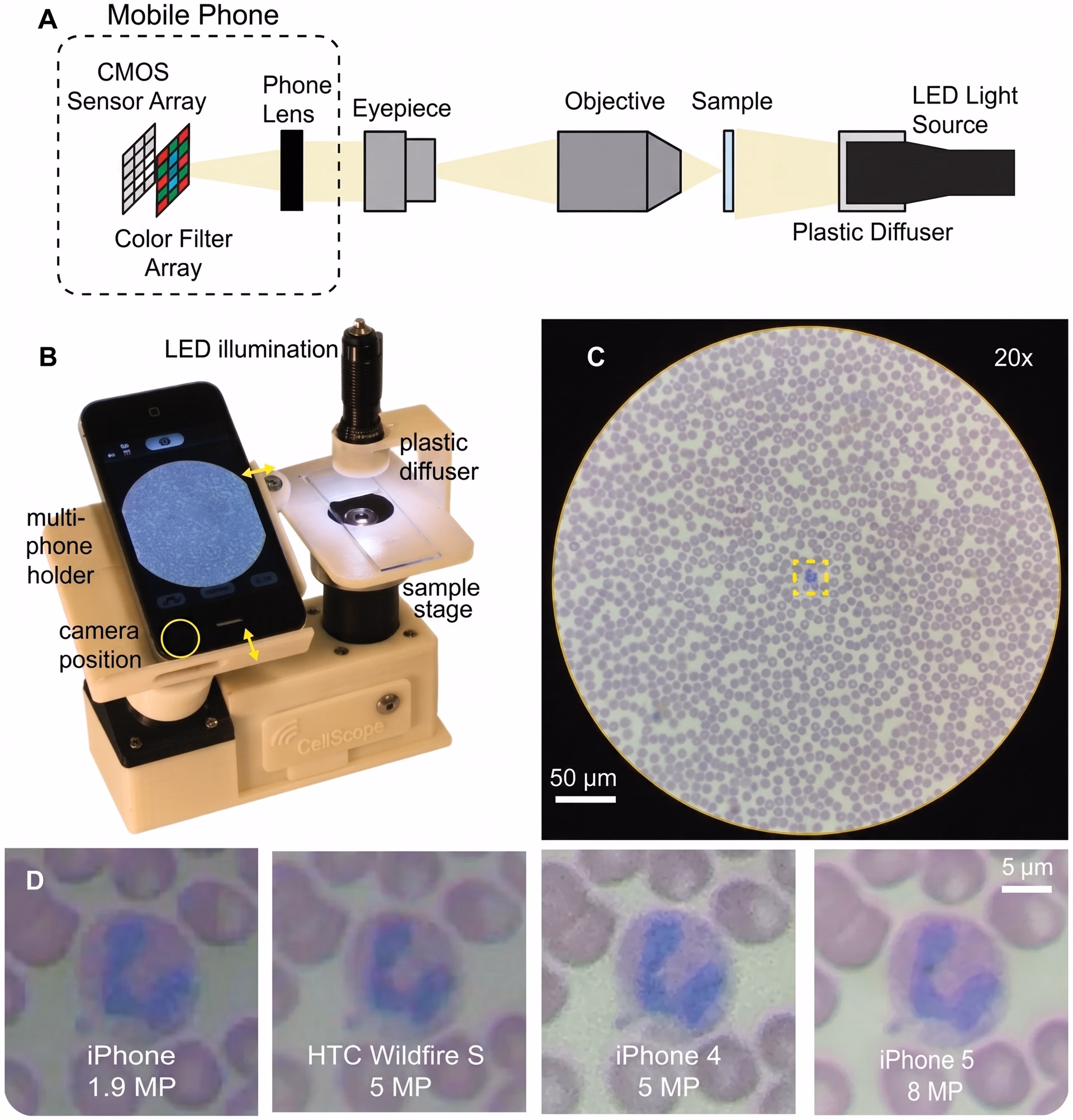 Utilisation d'un microscope basé sur un smartphone pour l'imagerie cellulaire
