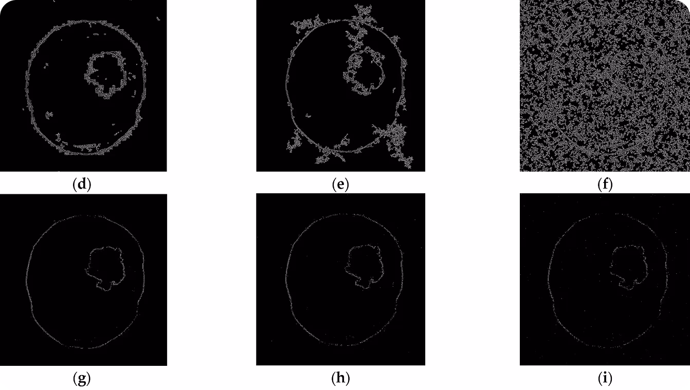 Canny fournit des contours plus nets que Sobel à mesure que le bruit augmente