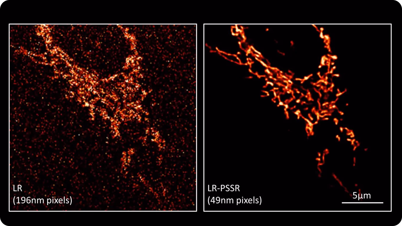 Un réseau mitochondrial dans une cellule cancéreuse, basse résolution versus amélioré par IA