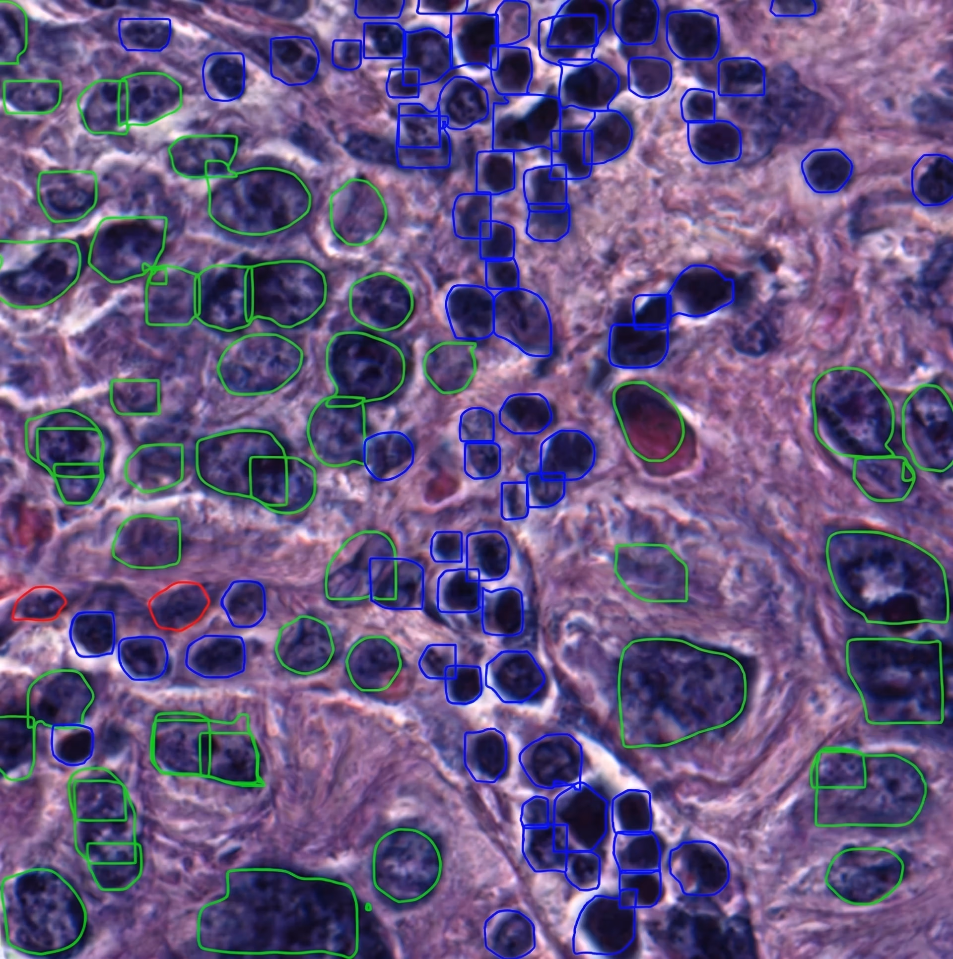 YOLO used for nucleus segmentation, outlining cell nuclei