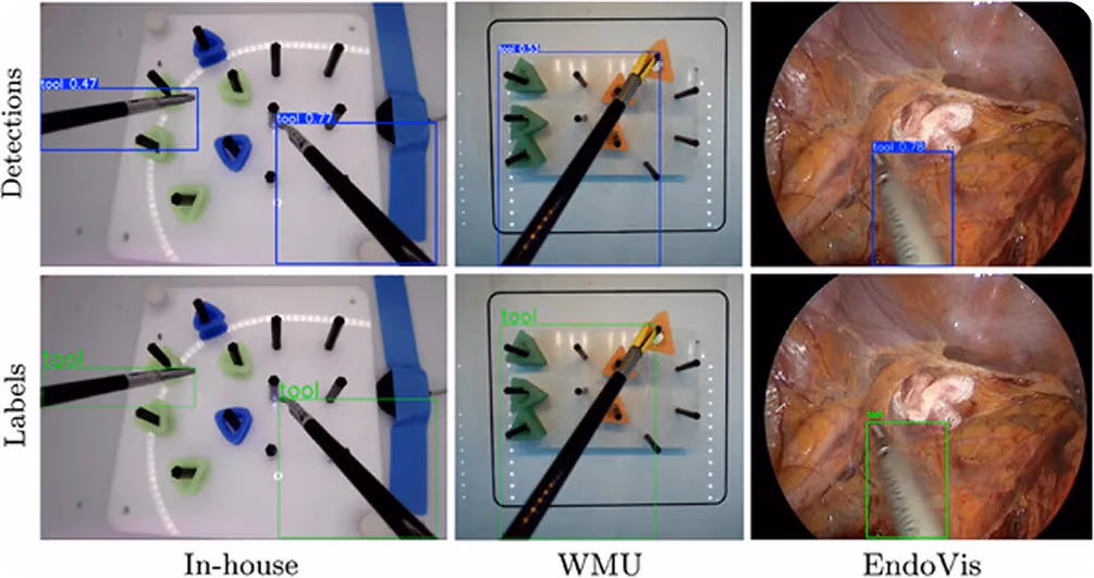 Real-time laparoscopic instrument detection using YOLO