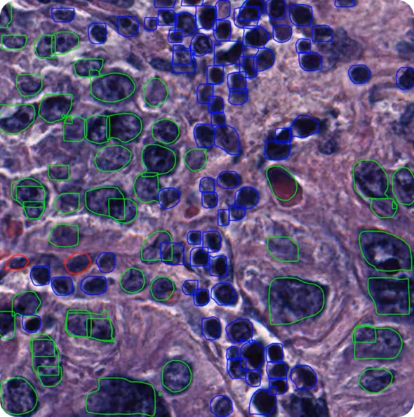 YOLO used for nucleus segmentation, outlining cell nuclei