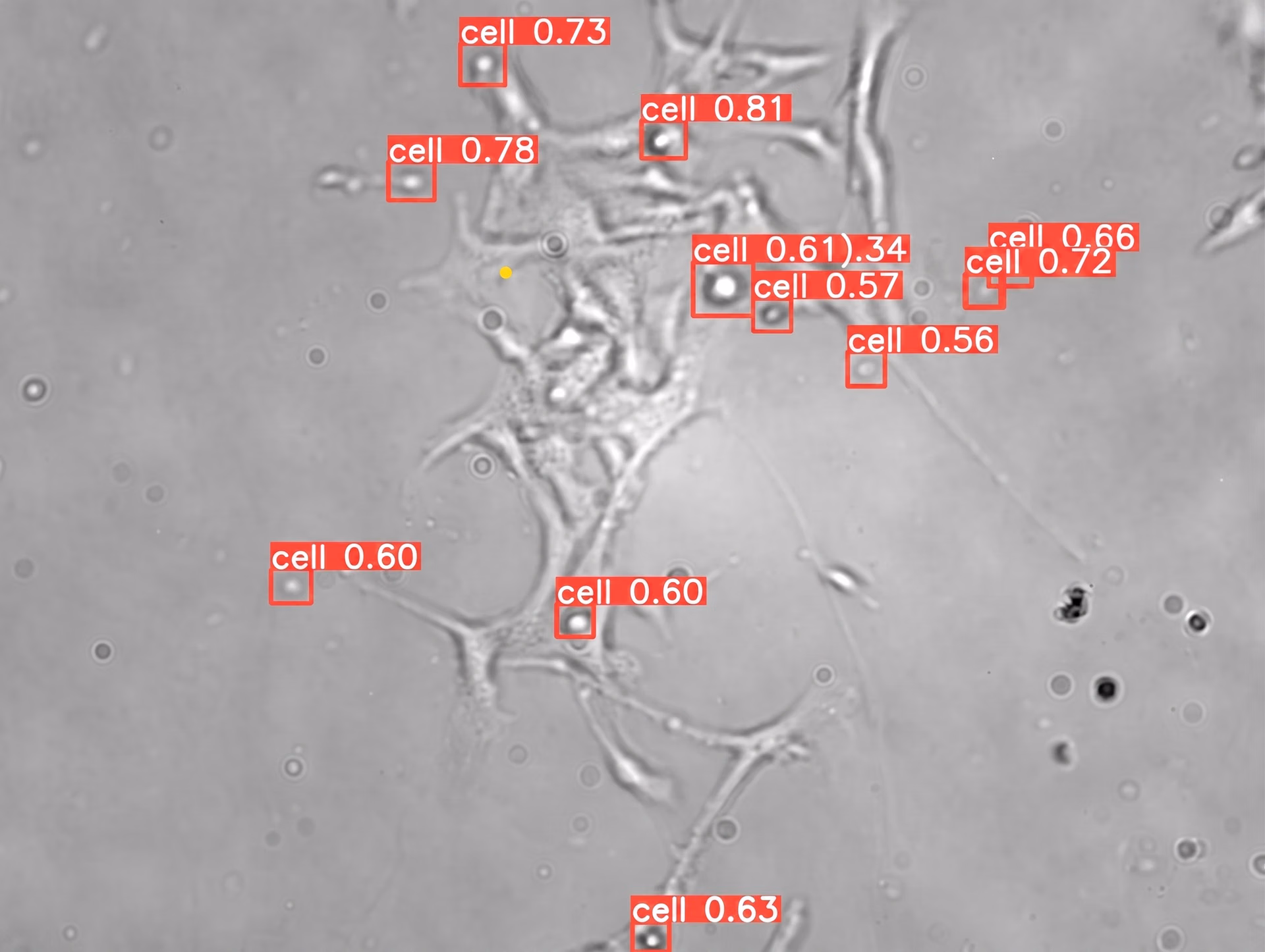 Segmentation results of Ultralytics YOLOv8 being used for cell detection