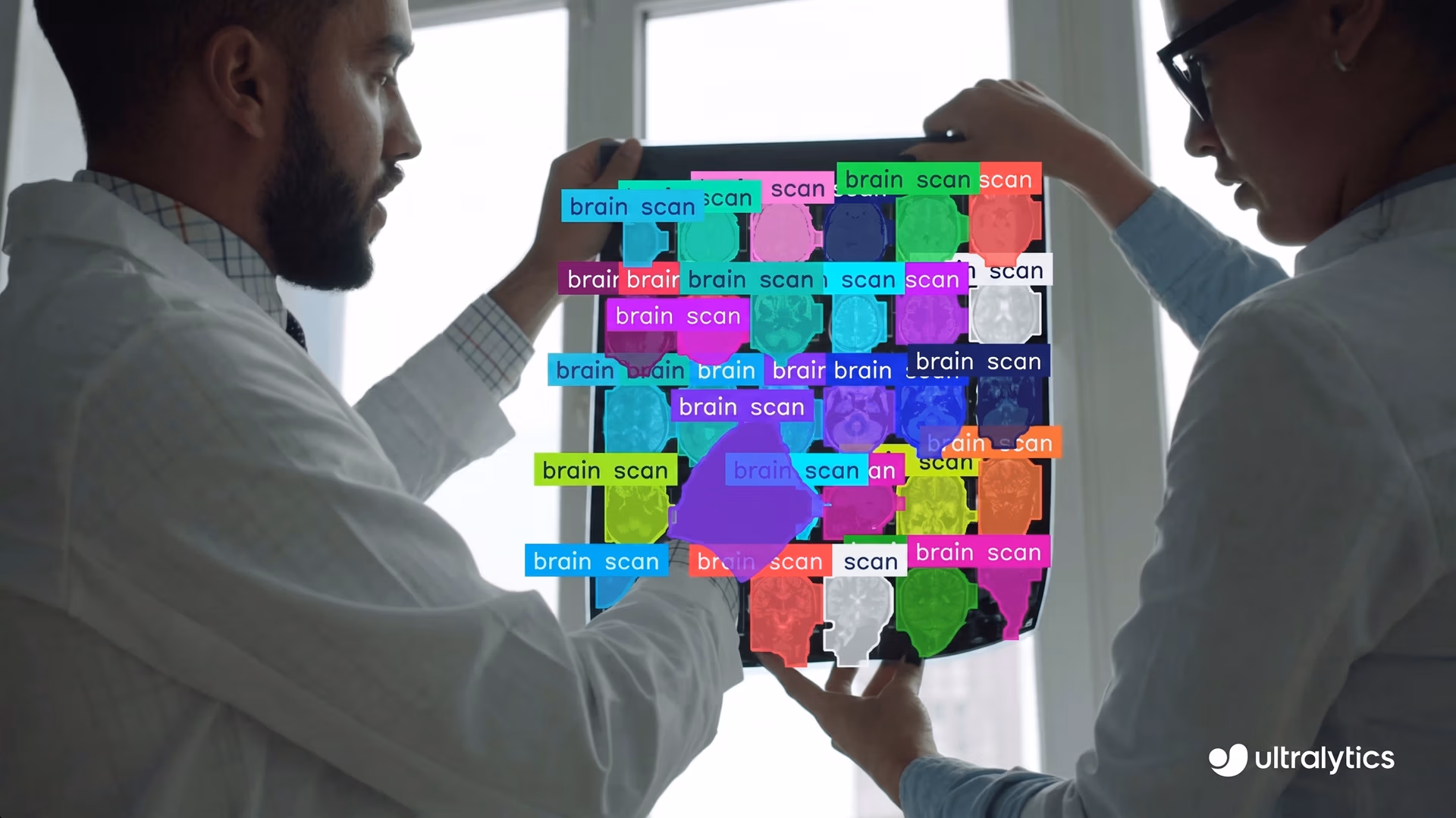AI-powered brain scan analysis using Ultralytics YOLO11